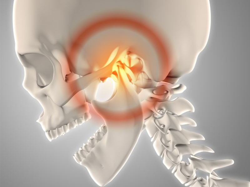 顎関節症治療