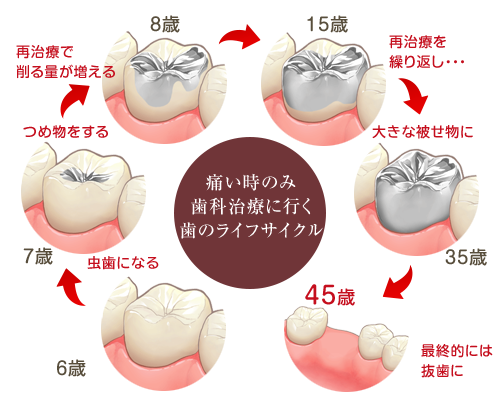 歯のサイクル