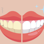 黄ばんだ歯と白い歯