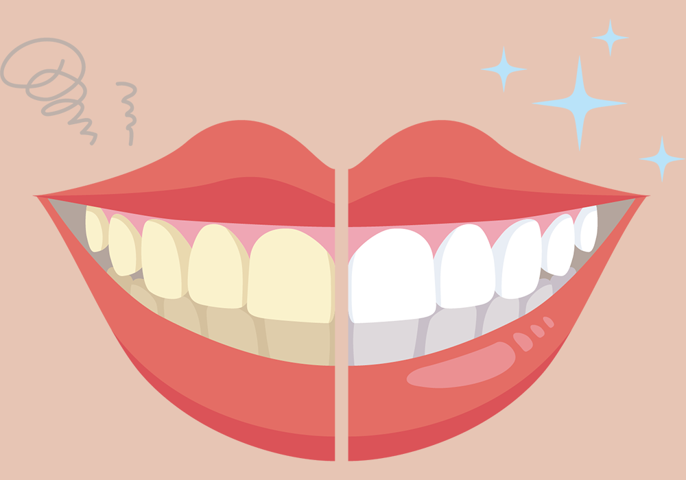黄ばんだ歯と白い歯
