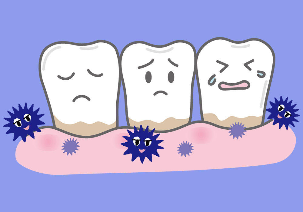 汚れがたまった歯